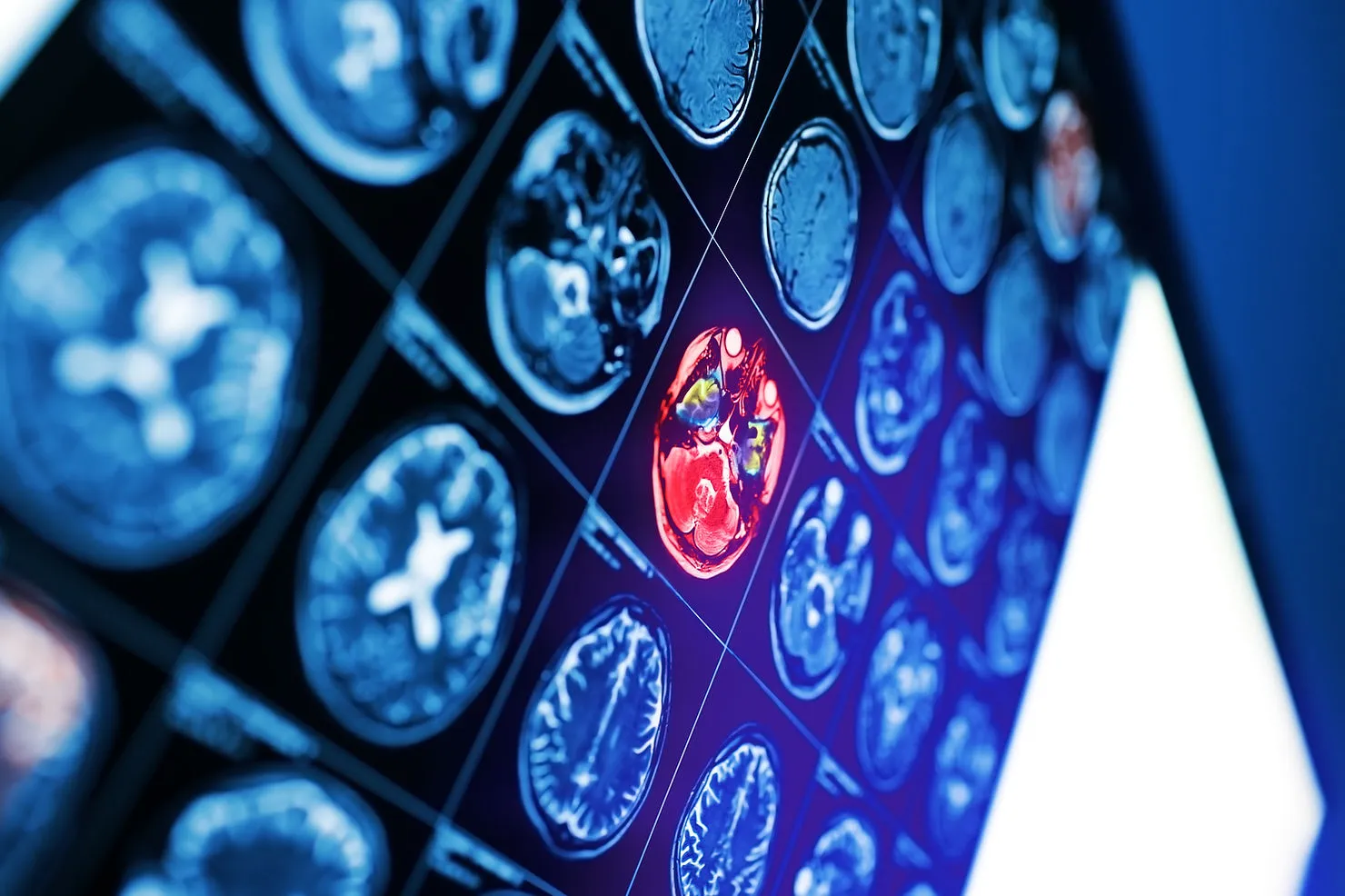 Conceptual image of an MRI scan of the brain, representing medical imaging data.